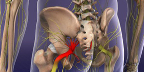 Sciatica Care Denver