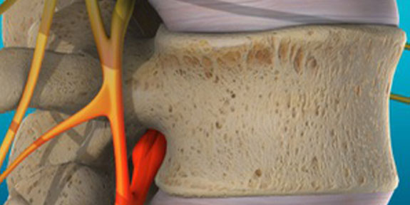 Vertebral Subluxation Denver