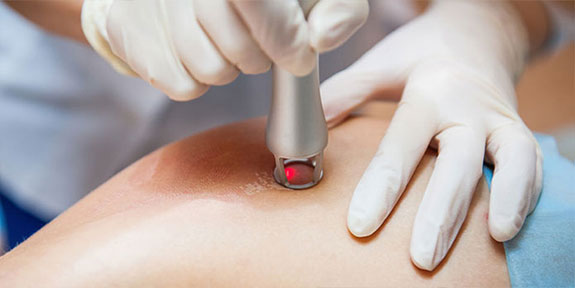 Cold Laser treatment at Center For Auto Accident Injury Treatment in Denver